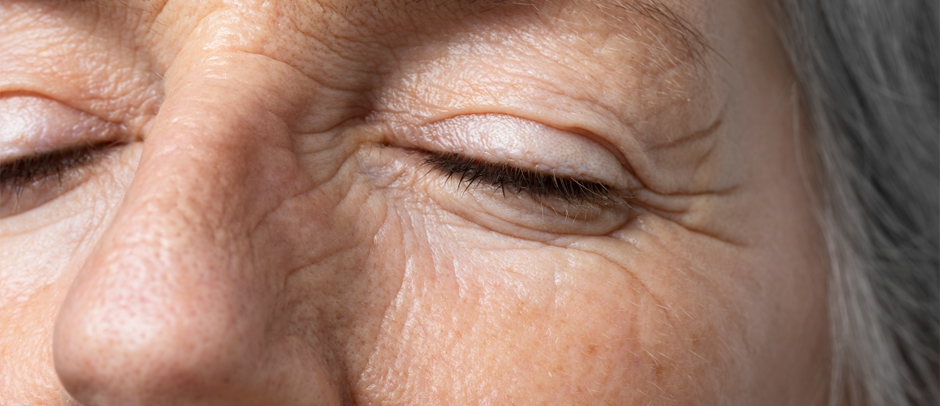 7 Surprising Foods That Are Secretly Aging Your Skin Faster