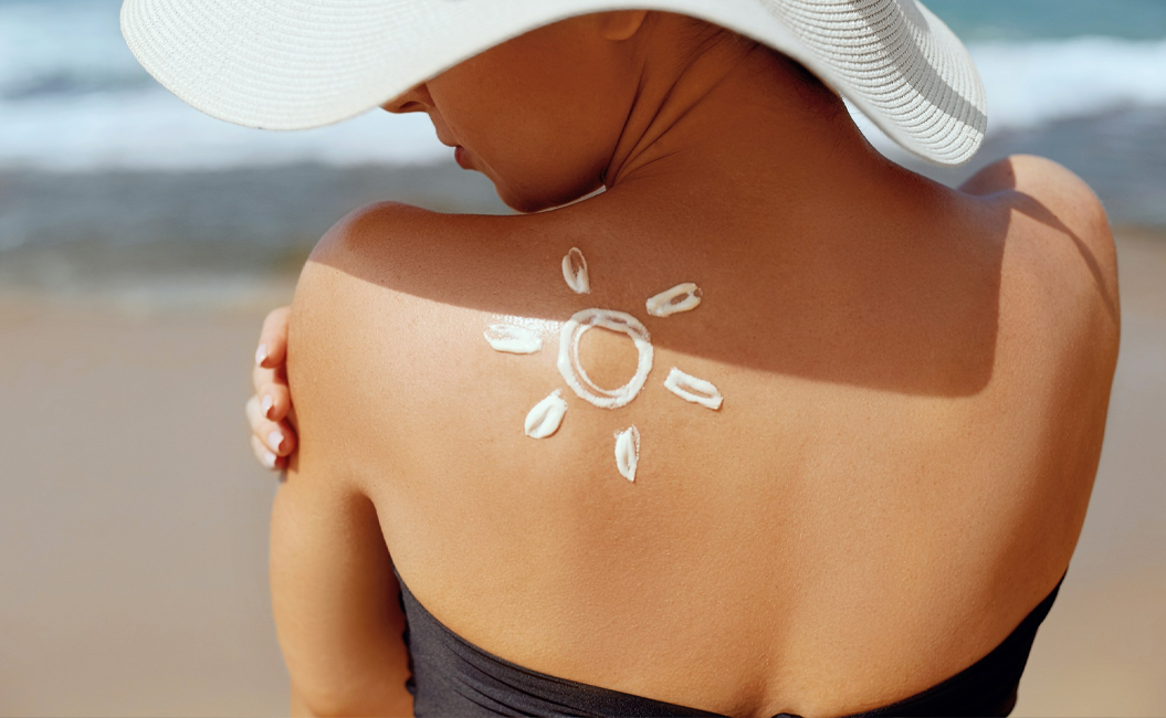 Sunburns or Melanoma? Say No More 9 Tips to Protect Your Skin from the Summer Sun